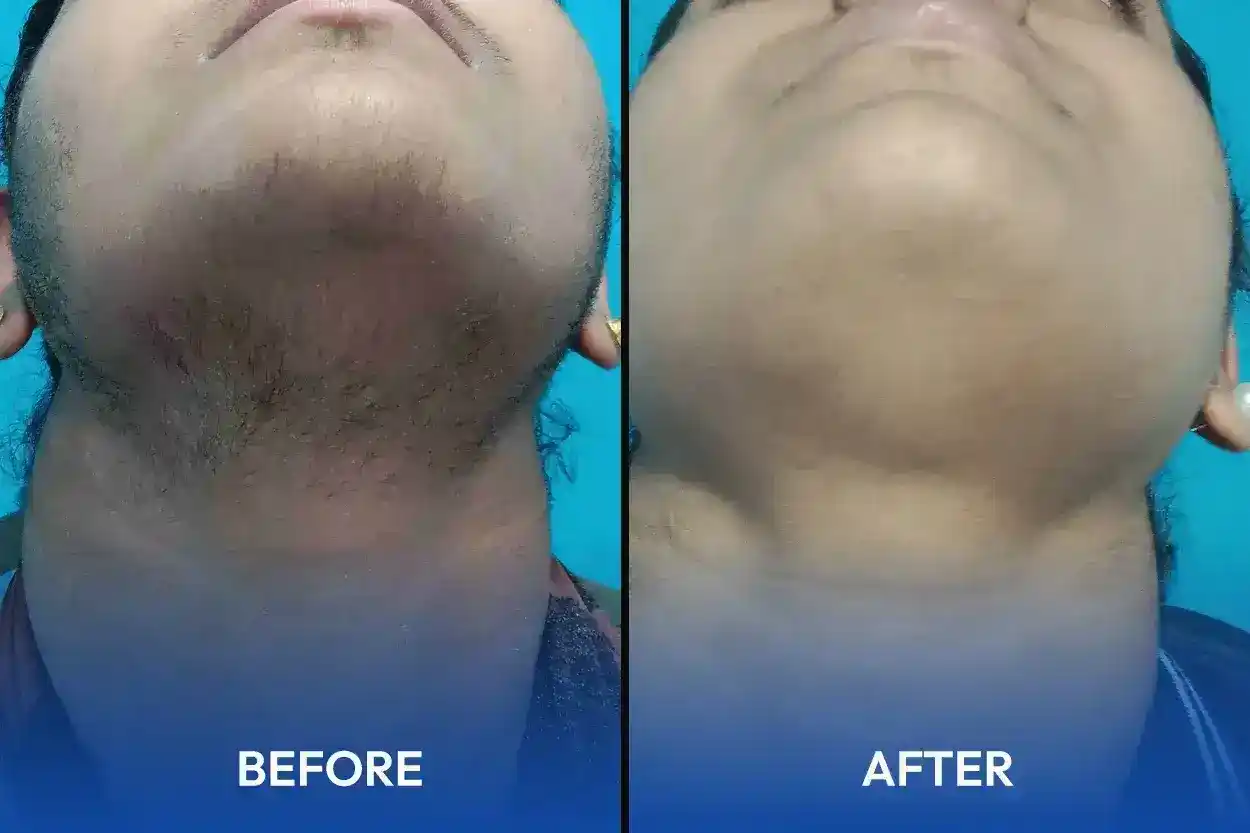 hair treatment specialist