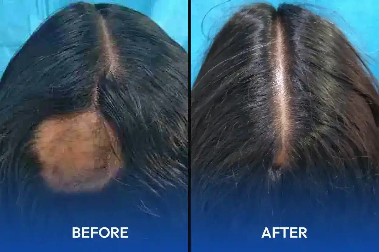 hair treatment specialist