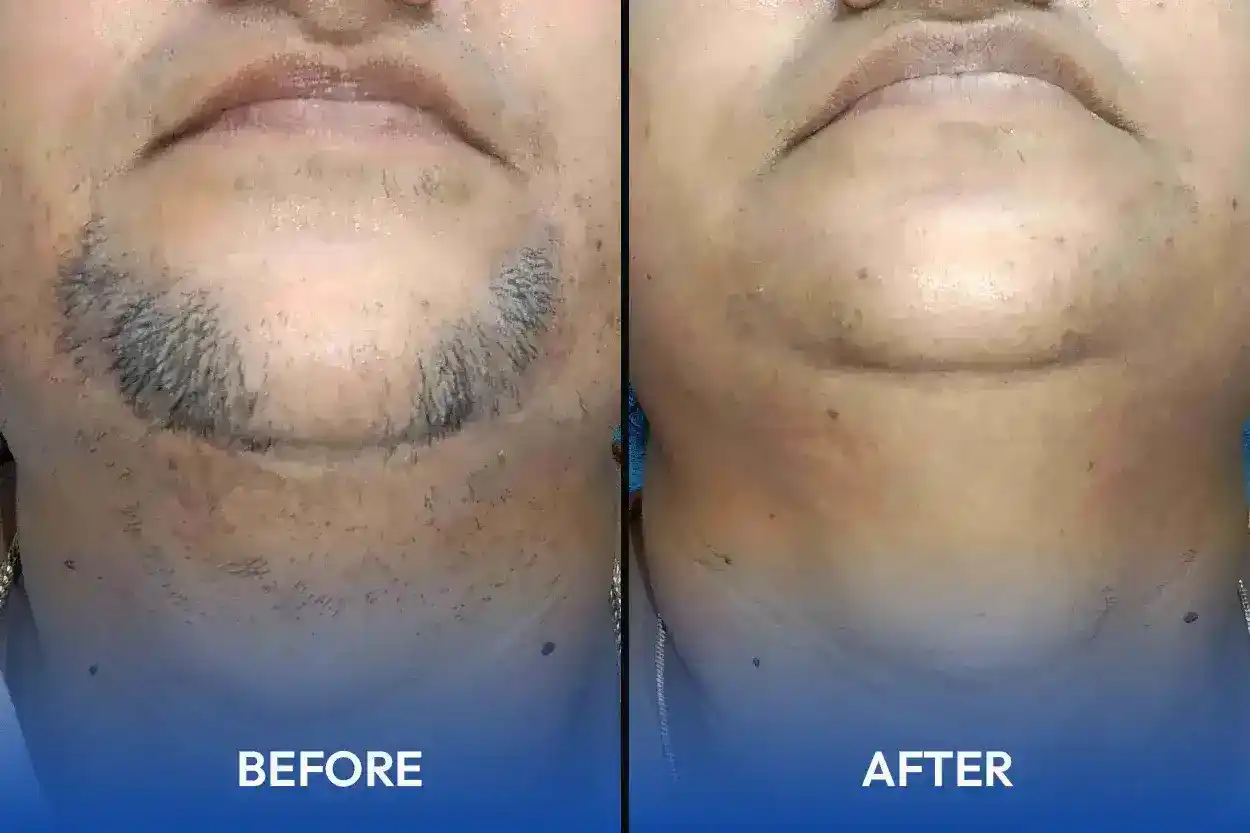 Hair and skin treatment