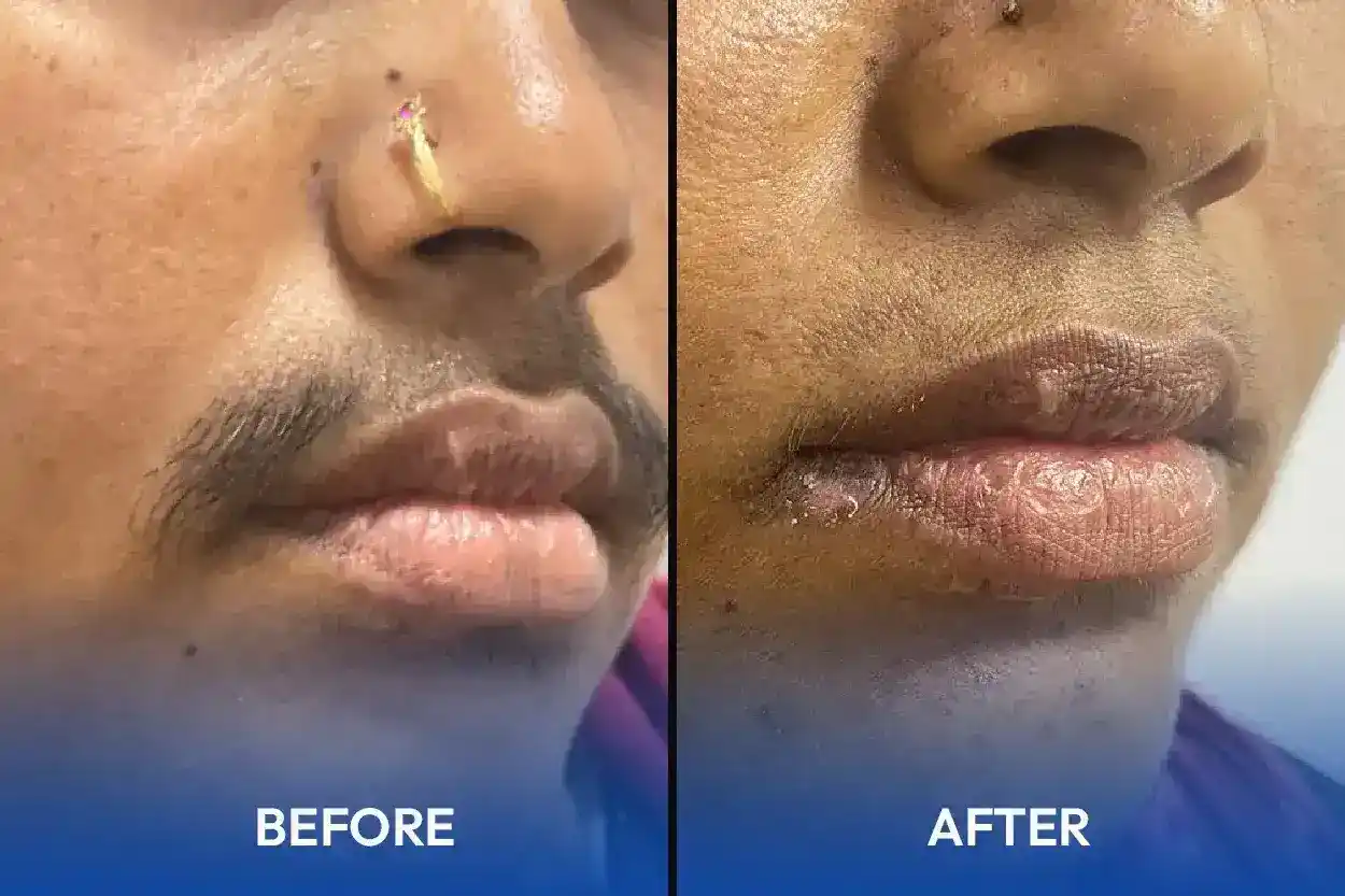 Hair and skin treatment