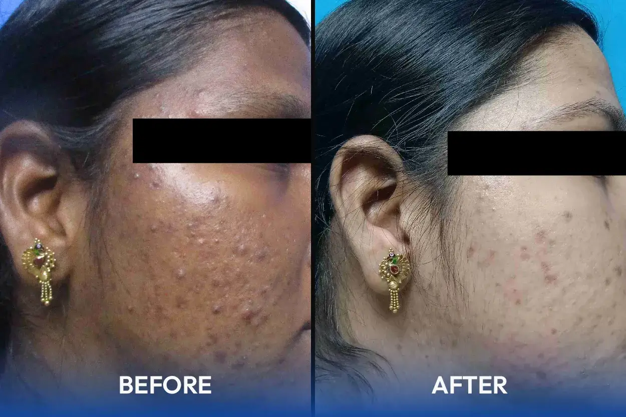 Hair and skin treatment