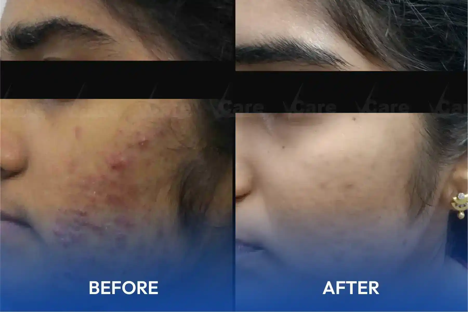 hair restoration clinic