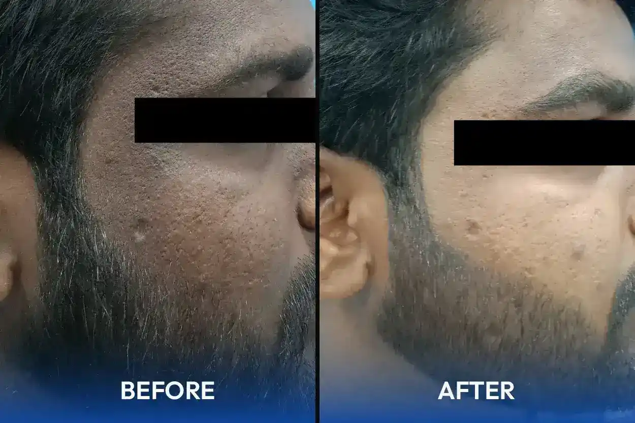 Hair and skin treatment