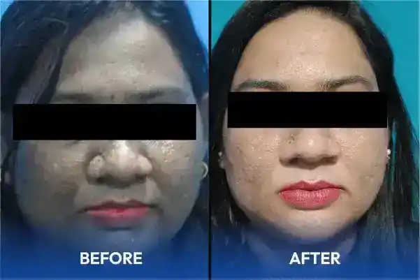 Hair and skin treatment