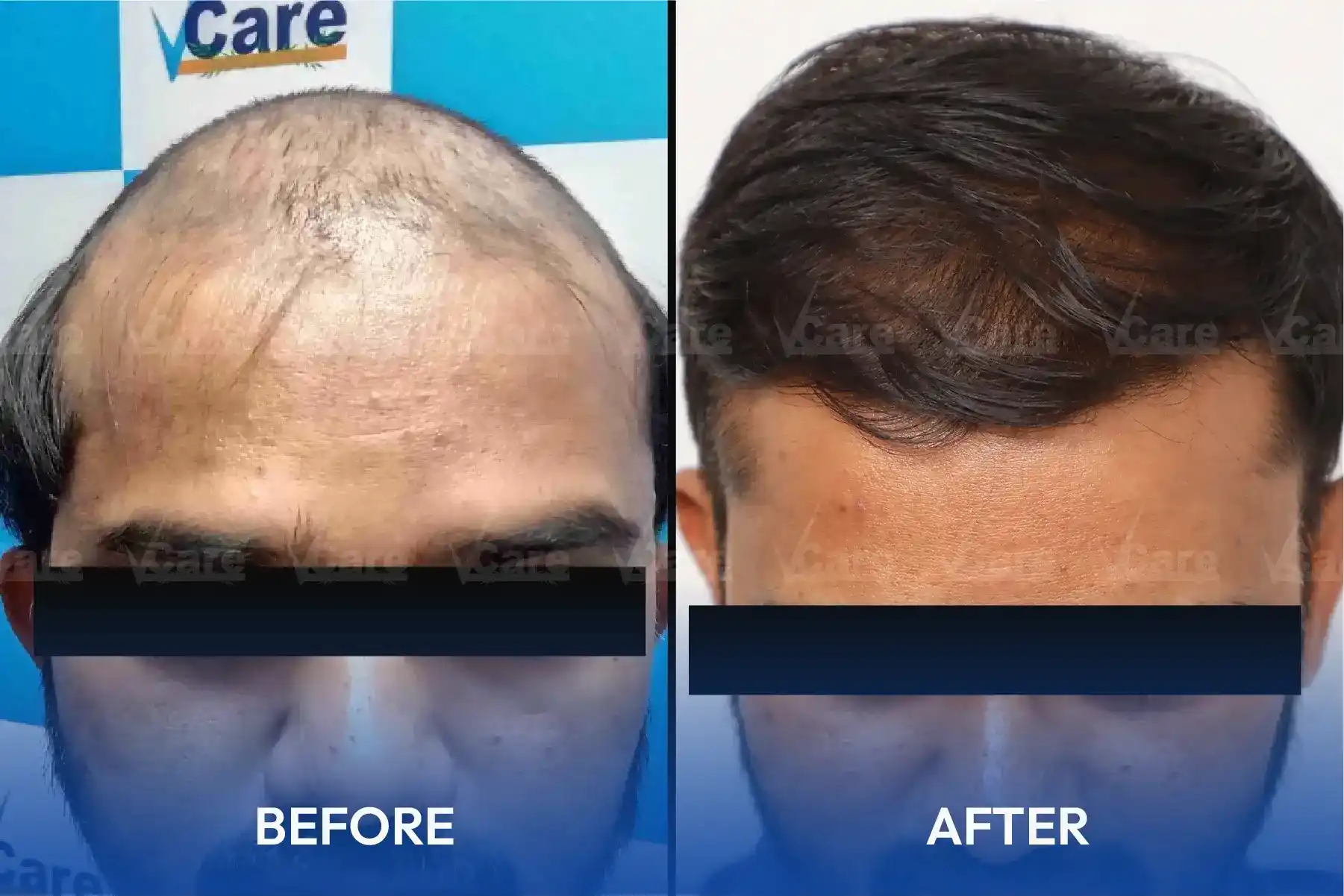 Hair and skin treatment